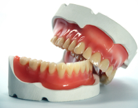 fotolia_4155315_xl-200x157[1]